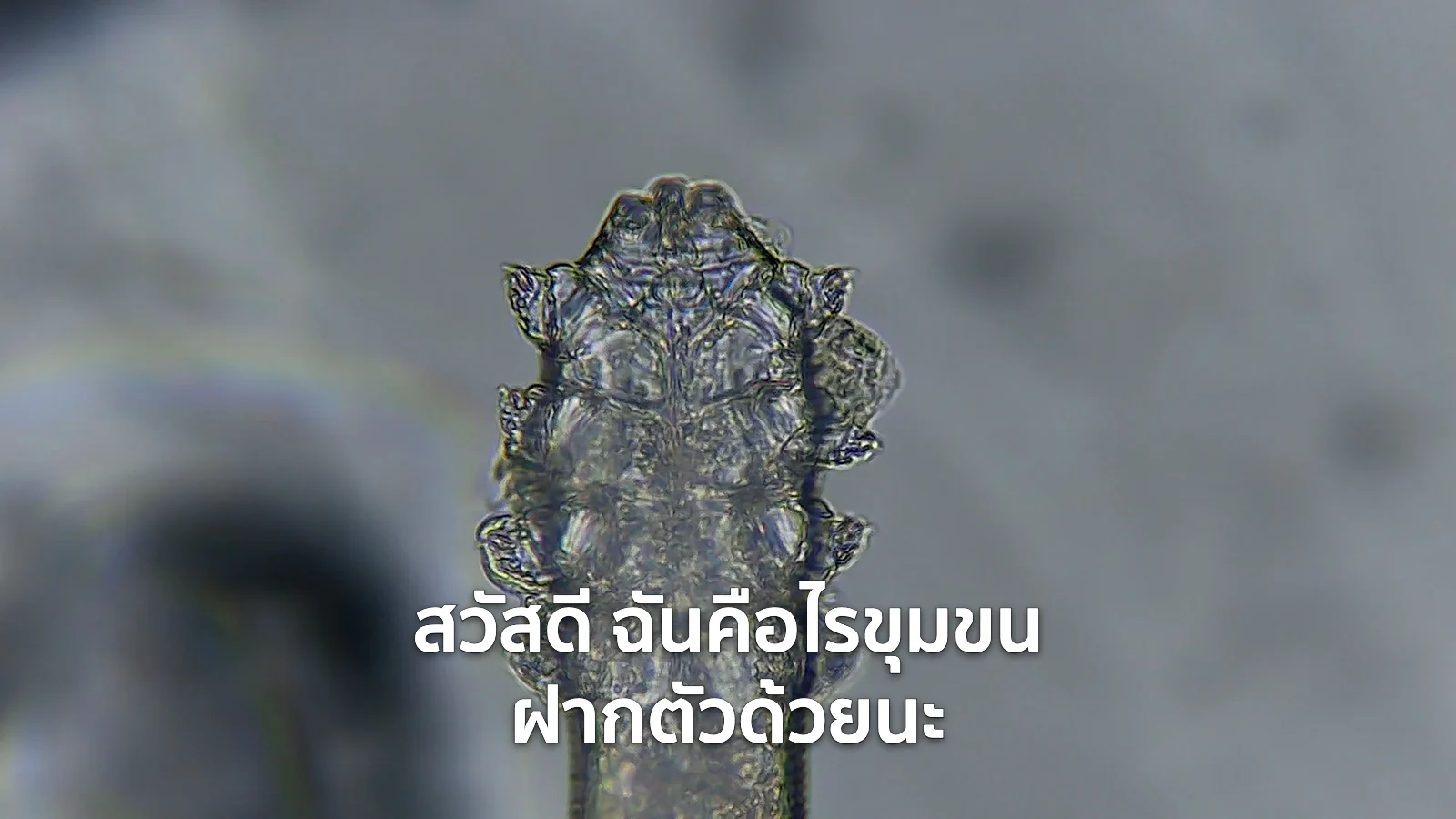 ภาพหน้าปกที่ขยายศีรษะและขาของไรขุมขนใต้กล้องจุลทรรศน์ แล้ววางข้อความ "สวัสดี ฉันคือไรขุมขน ฝากตัวด้วยนะ" ไว้ด้านบน