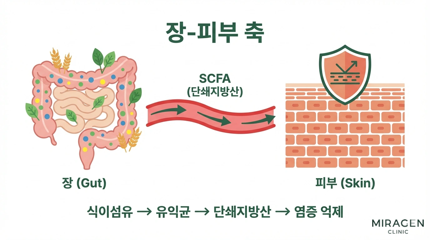 유산균과 식이섬유가 장내 미생물을 통해 단쇄지방산을 생성하고, 이것이 전신 염증을 억제하며 피부 장벽을 강화하는 장-피부 축 기전을 단계별로 보여주는 인포그래픽