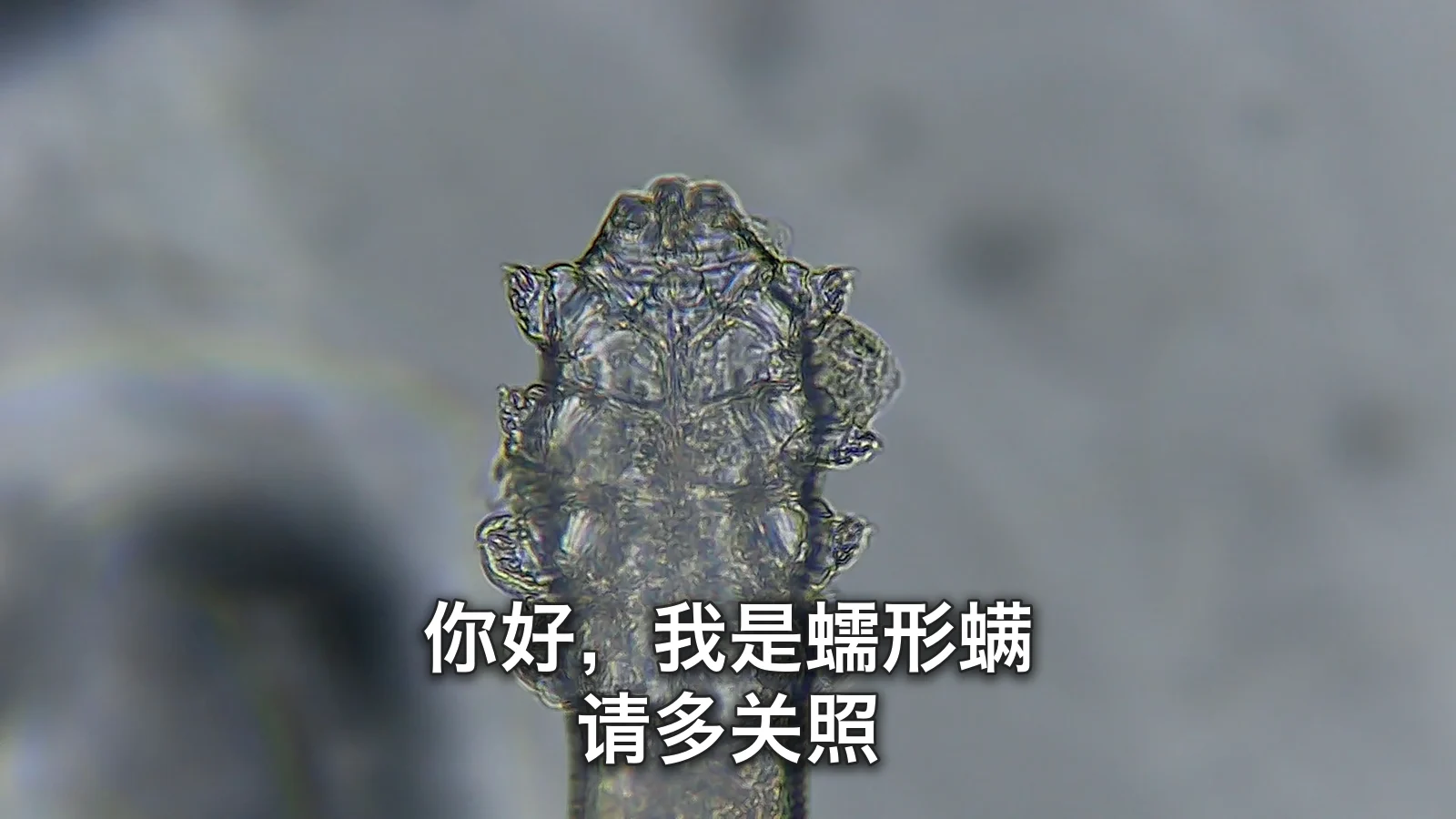 显微镜下大幅放大的蠕形螨头部和腿部，上面叠加了“你好，我是蠕形螨。请多关照”字样的代表图片