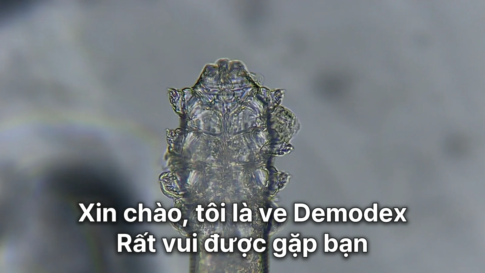 Ảnh đại diện: đầu và chân ve Demodex được phóng đại lớn dưới kính hiển vi, bên trên có dòng chữ "Xin chào, tôi là ve Demodex. Rất vui được gặp bạn"