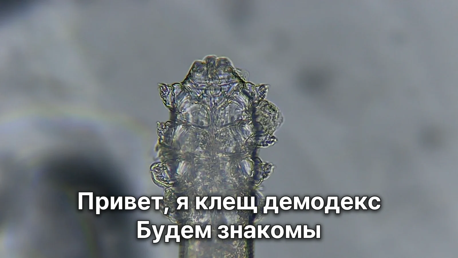 Обложка: над увеличенными под микроскопом головой и ножками клеща демодекс размещена надпись «Привет, я клещ демодекс. Будем знакомы»
